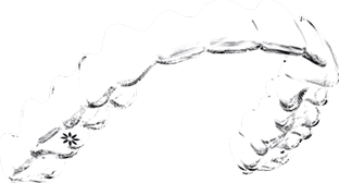 マウスピース 矯正